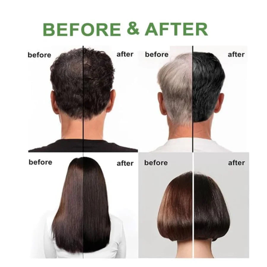Natural Fruit Vineger Black Gel Hair Color | Natural Hair Dye for Men & Women | No Ammonia & No PPD, Long-Lasting, Gentle on Scalp | 100% Gray Hair Coverage