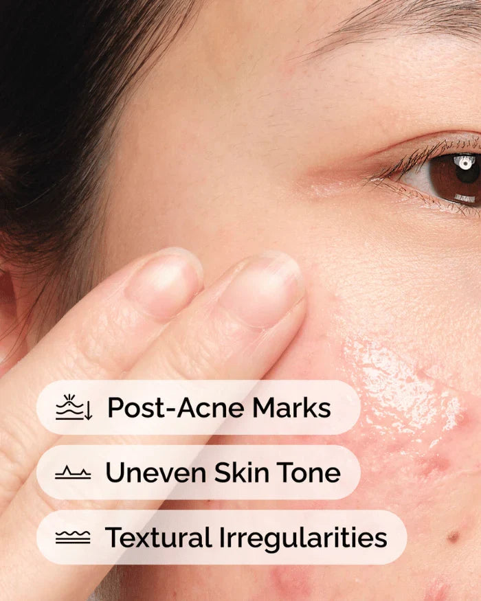 The Ordinary Niacinamide 10% + Zinc 1%: Your Go-To Solution for Flawless Skin